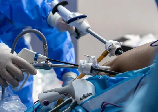 Bariatric surgery