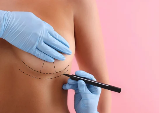 What is Breast Augmentation Surgery?