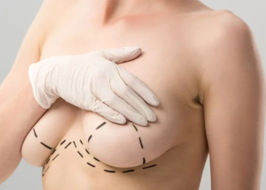 Breast Lift: Reasons and Procedures