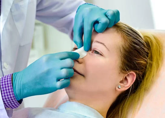 Everything about Nose Splints