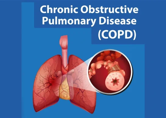 Chronic Obstructive Pulmonary Disease (COPD): Causes, Symptoms, and Treatment