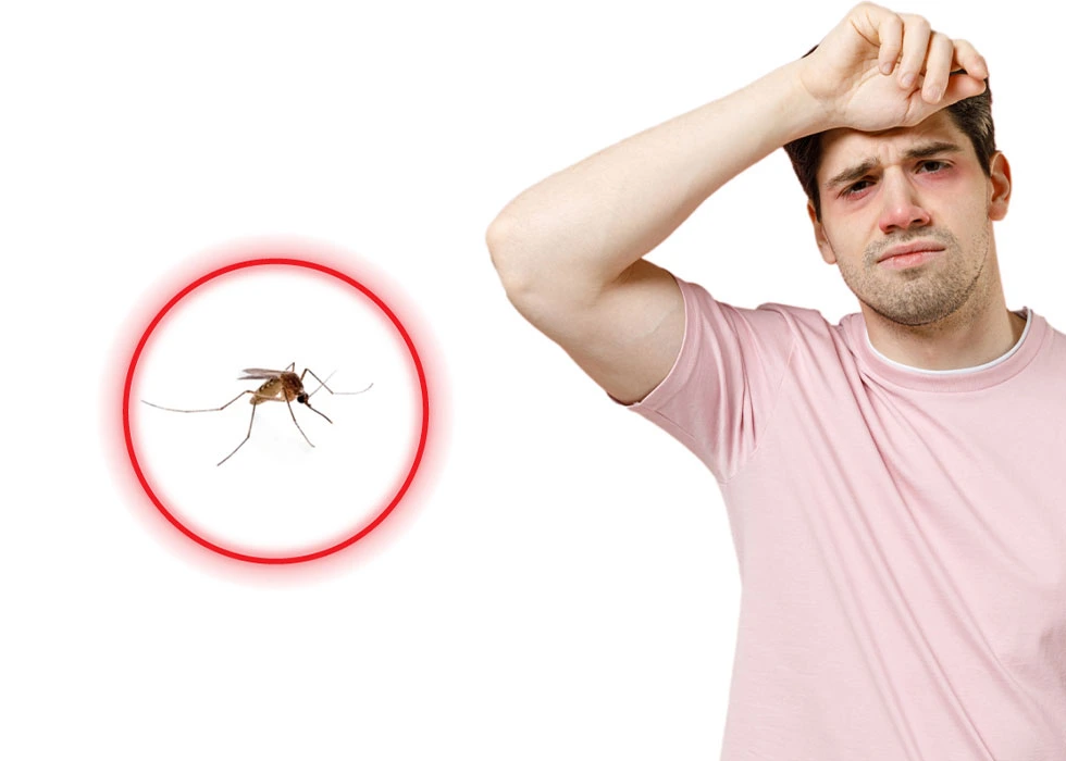 Dengue Fever: Symptoms, Causes, Treatment, and Prevention