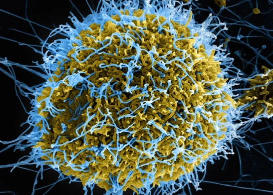 Ebola Virus Disease (EVD): Symptoms, Transmission, Treatment & Prevention