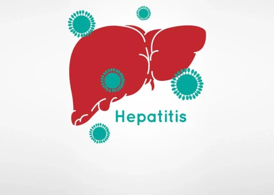 Hepatitis: Causes, Types, Symptoms, Prevention, and Treatment