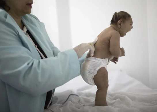 Zika Virus: Symptoms, Risks, and Prevention Strategies
