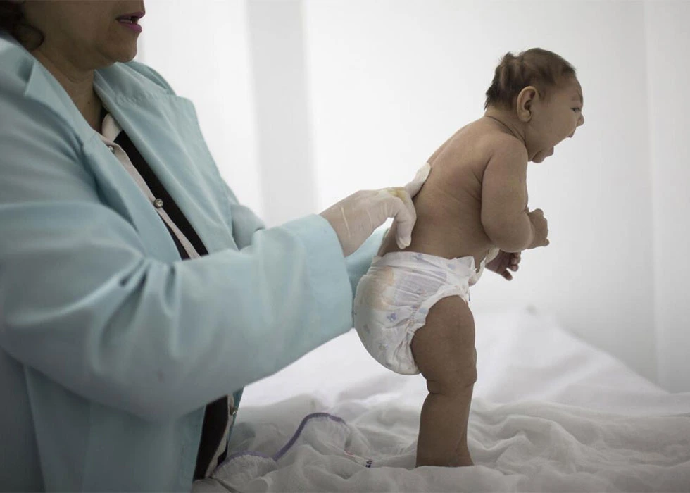 Zika Virus: Symptoms, Risks, and Prevention Strategies